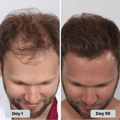 Red Light Therapy Cap for Hair Regrowth